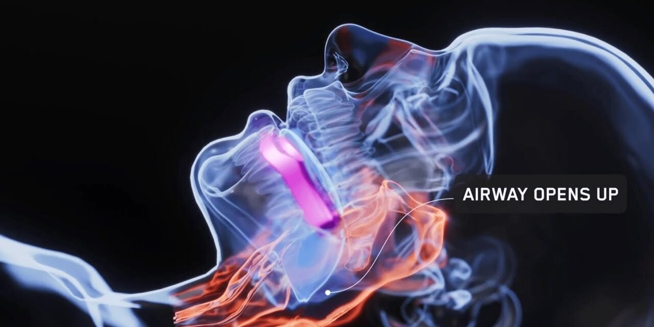 How the AIRWAAV RX1 Recovery Mouthpiece Works (Science Explained)