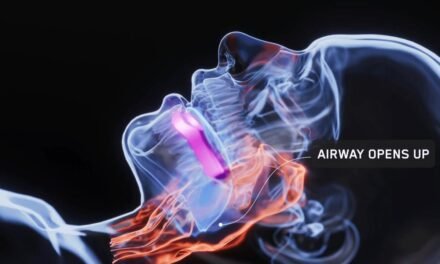 How the AIRWAAV RX1 Recovery Mouthpiece Works (Science Explained)