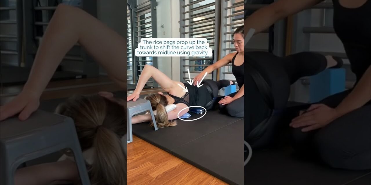 Scoliosis Treatment using Schroth Method – Sidelying Correction