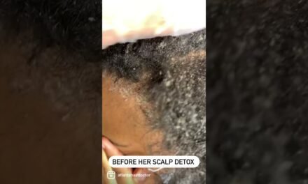 How to do a scalp detox