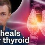 How to Heal Hypothyroidism and Hashimoto's Naturally