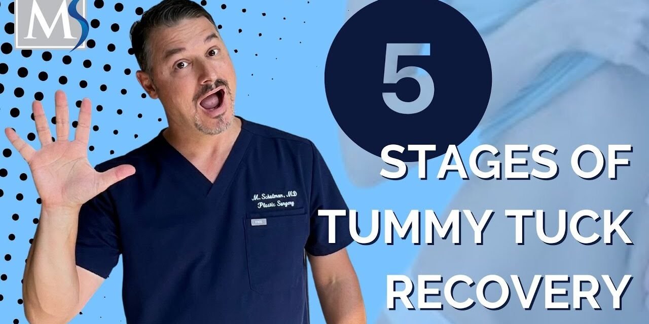 Tummy Tuck Recovery – 5 stages