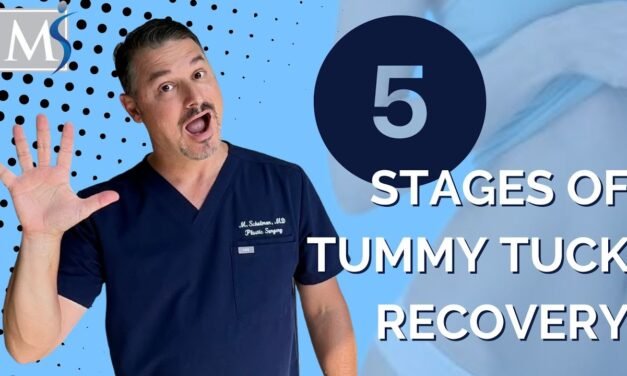 Tummy Tuck Recovery – 5 stages